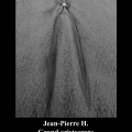 Jena-Pierre H. Hypocondriaque grand et courtois
