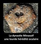 Minasoif et Ophtalmologie